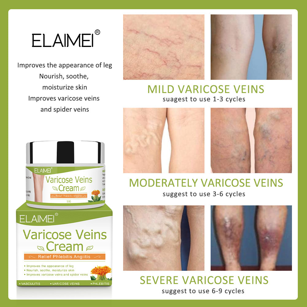 ELAIMEI Varicose Veins and Spider Veins Treatment Relief Cream