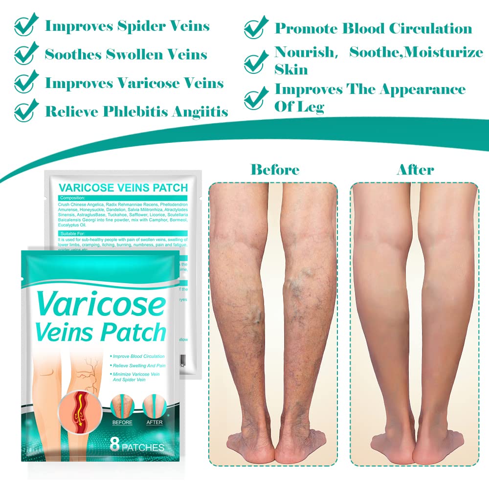 8 PCS Varicose Veins Patches Treatment For Varicose Veins i.e spider veins
