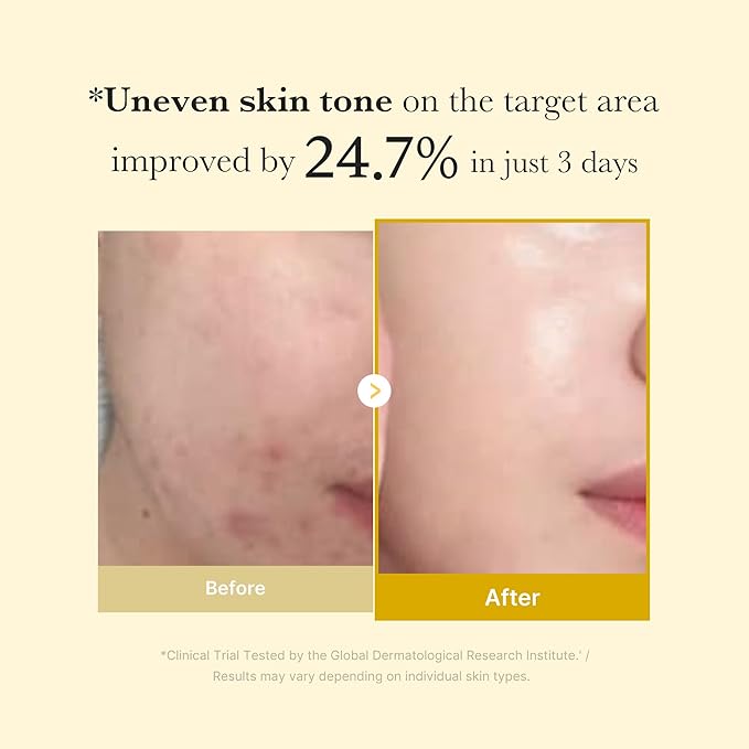 medicube Kojic Acid Turmeric Overnight Wrapping Peel Off Mask – Brightens & Defends Against Skin Stress for a Clear, Glowing Complexion