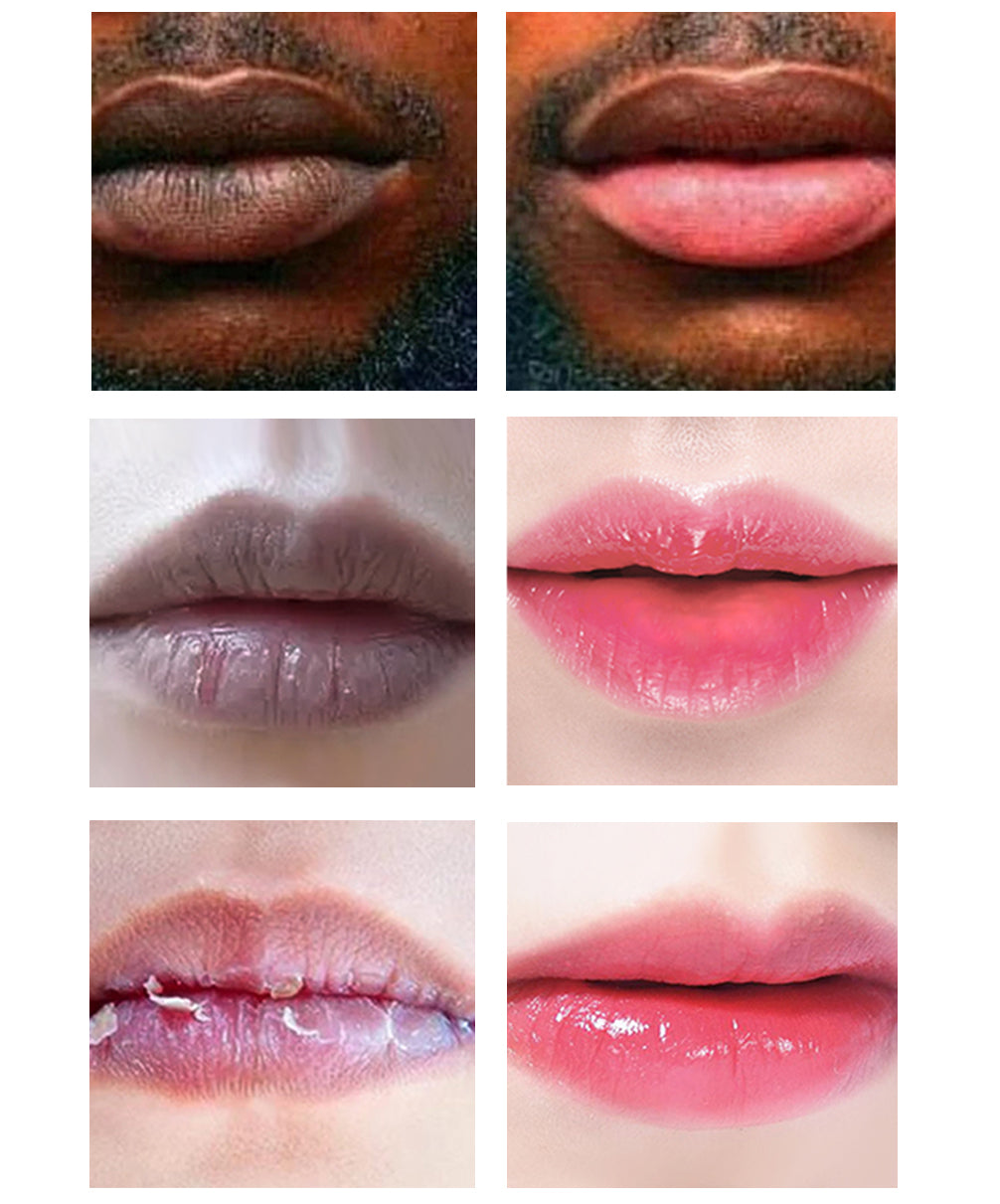 YOXIER Lip Lightening Scrub Balm for Dark Lips 20G