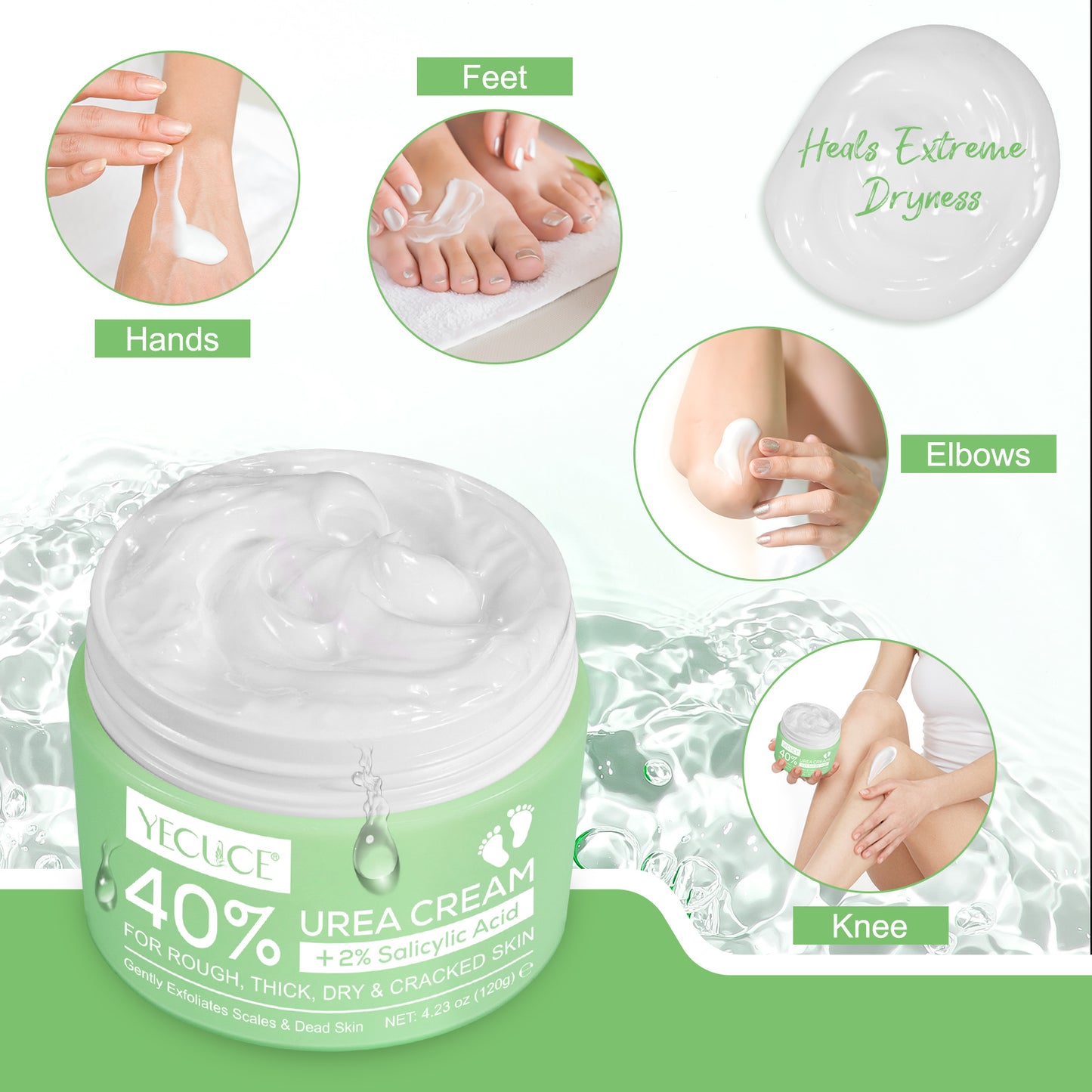 YECUCE 40% Urea Foot Cream, Softens Heels, Callouses, Moisturizes Rough Dry Cracked Feet and Hands