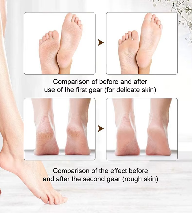 Rechargeable Electric Foot File Callus Remover for smooth soft feet