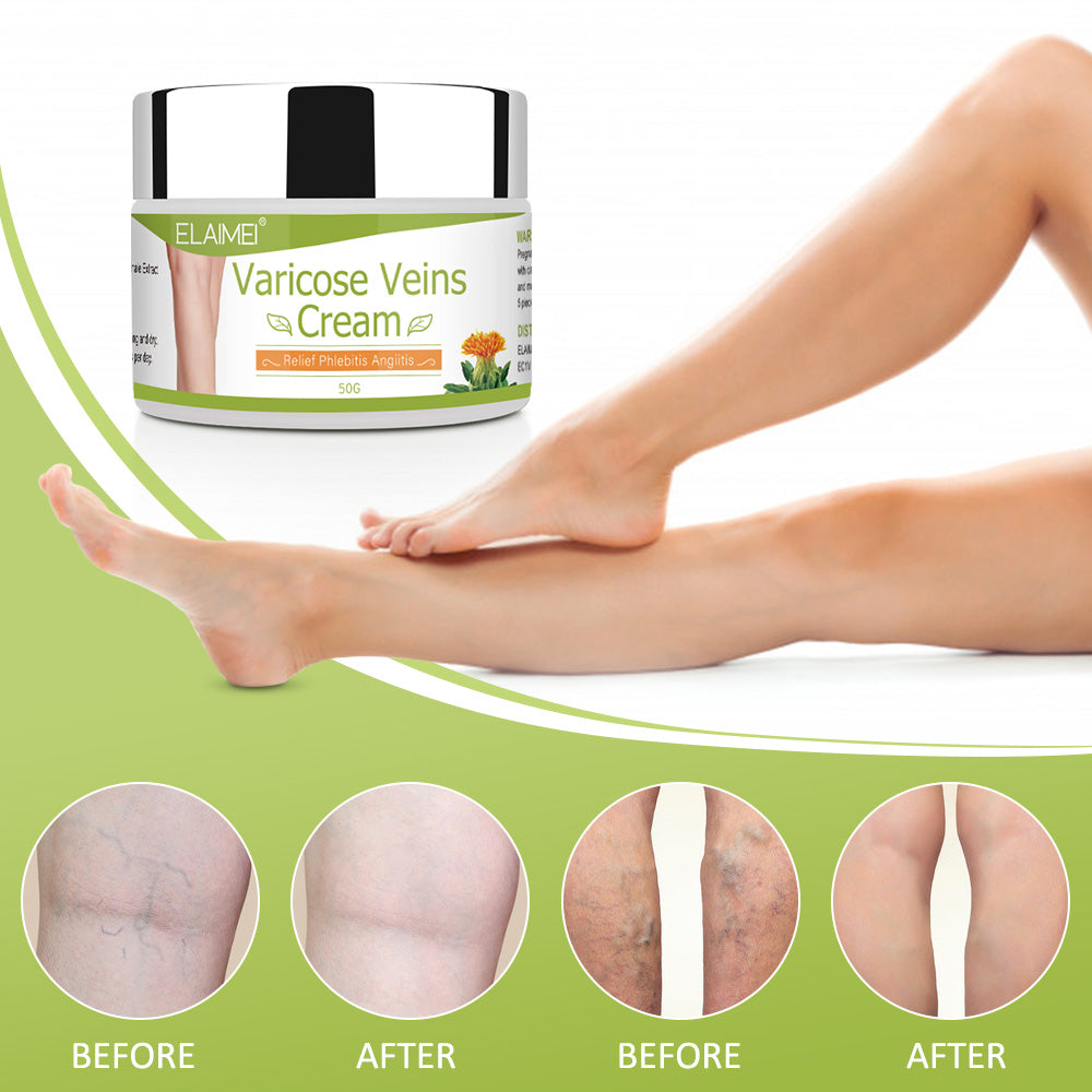 ELAIMEI Varicose Veins and Spider Veins Treatment Relief Cream