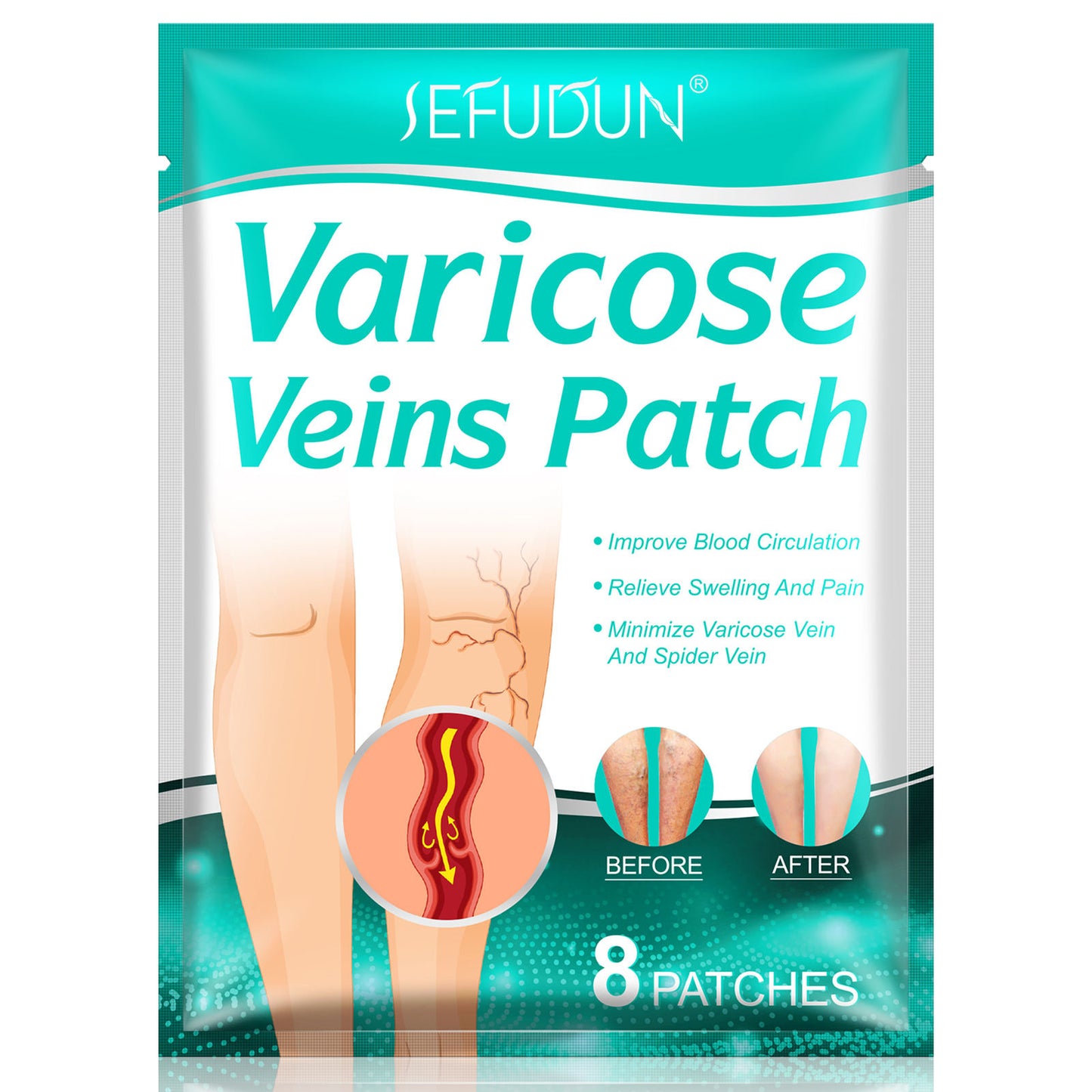 8 PCS Varicose Veins Patches Treatment For Varicose Veins i.e spider veins
