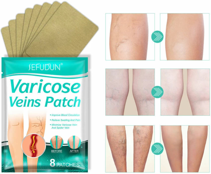 8 PCS Varicose Veins Patches Treatment For Varicose Veins i.e spider veins