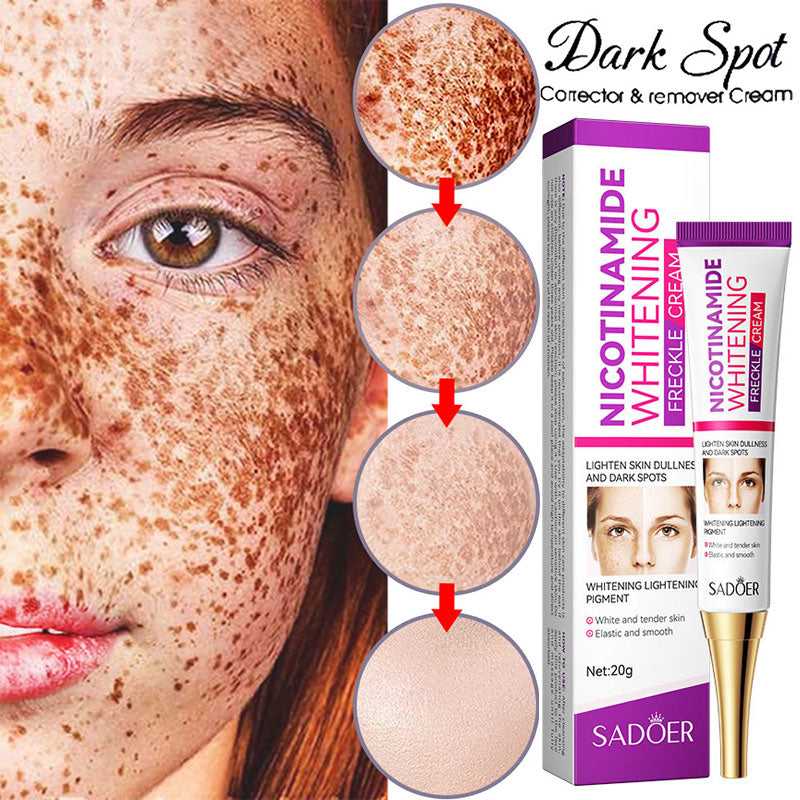 Melasma fading and Freckles Removal Nicotinamide Cream