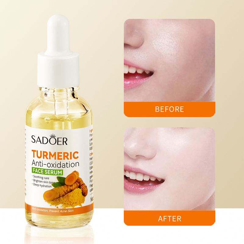 Organic Turmeric Face Serum Antioxidant/ Anti-aging /Hydrating/Anti-Acne/Dark Spots Corrector