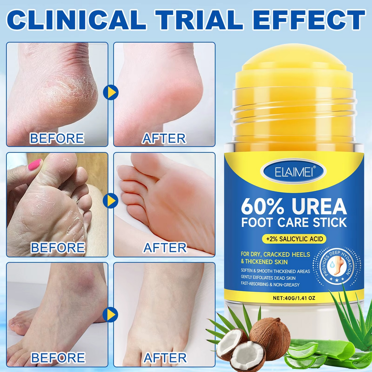 ELAIMEI 60% Urea Exfoliating Foot Cream Stick