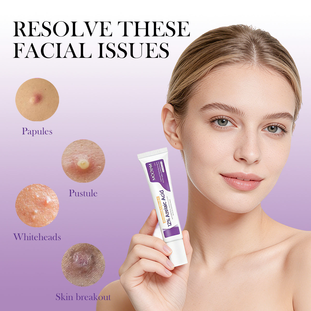 12%Azelaic Acid Cream with Niacinamide and Vitamin C for acne Prone Skin, Sensitive Skin, Large Pores and Pigmentation