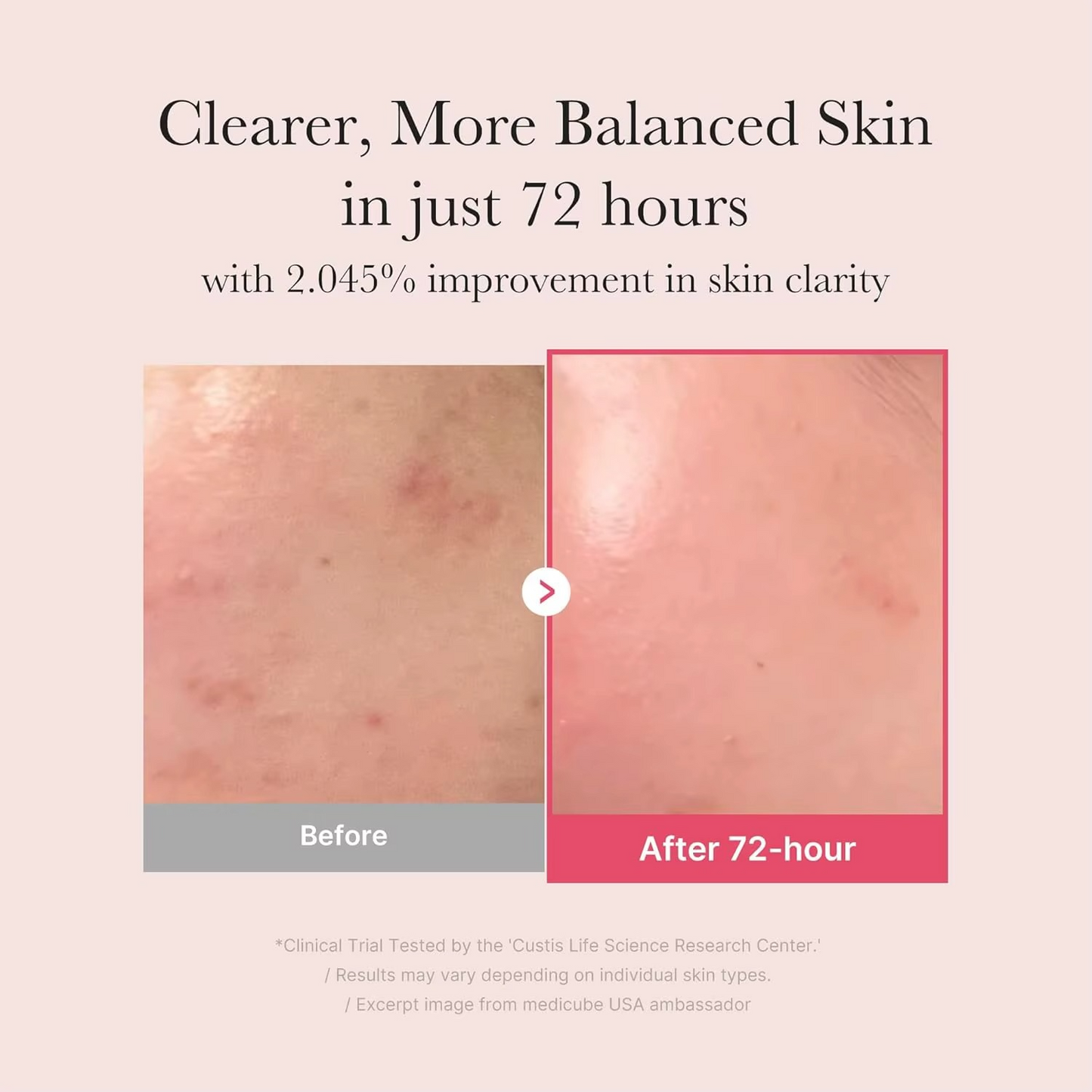 Medicube TXA+Niacinamide 15% Glow Facial Serum for After Spot Care