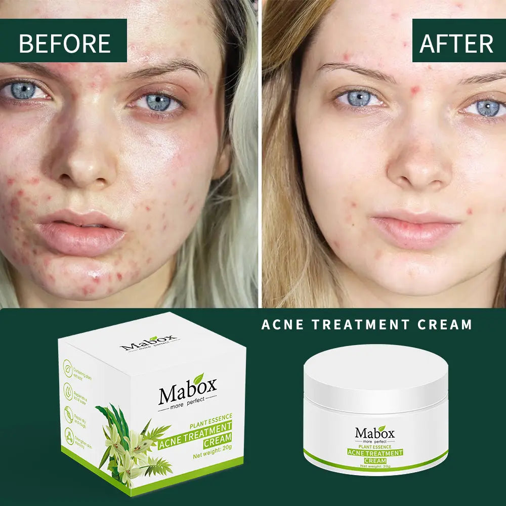 Mabox More Perfect 20g 100% Pure Natural Plant Whitening Moisturizing Acne Treatment Cream