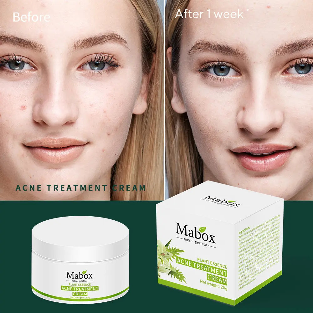 Mabox More Perfect 20g 100% Pure Natural Plant Whitening Moisturizing Acne Treatment Cream