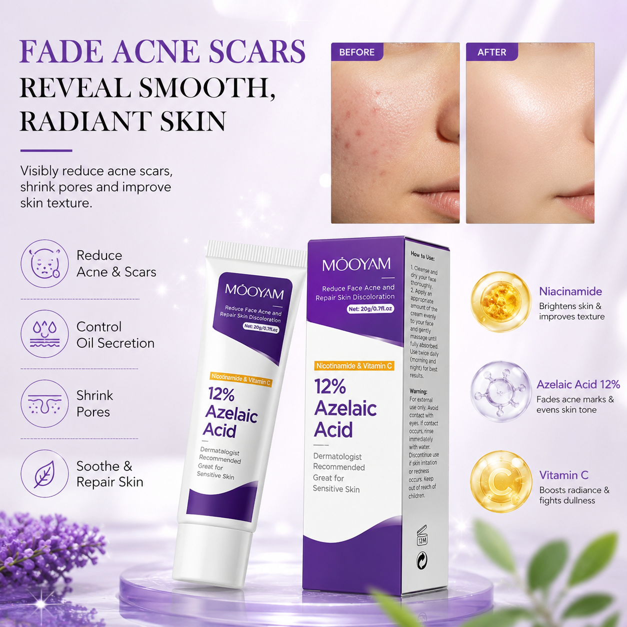 12%Azelaic Acid Cream with Niacinamide and Vitamin C for acne Prone Skin, Sensitive Skin, Large Pores and Pigmentation