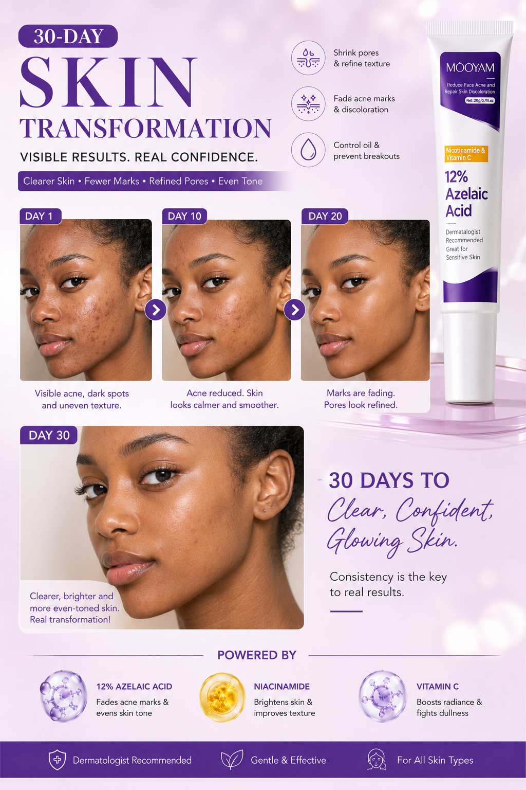 12%Azelaic Acid Cream with Niacinamide and Vitamin C for acne Prone Skin, Sensitive Skin, Large Pores and Pigmentation