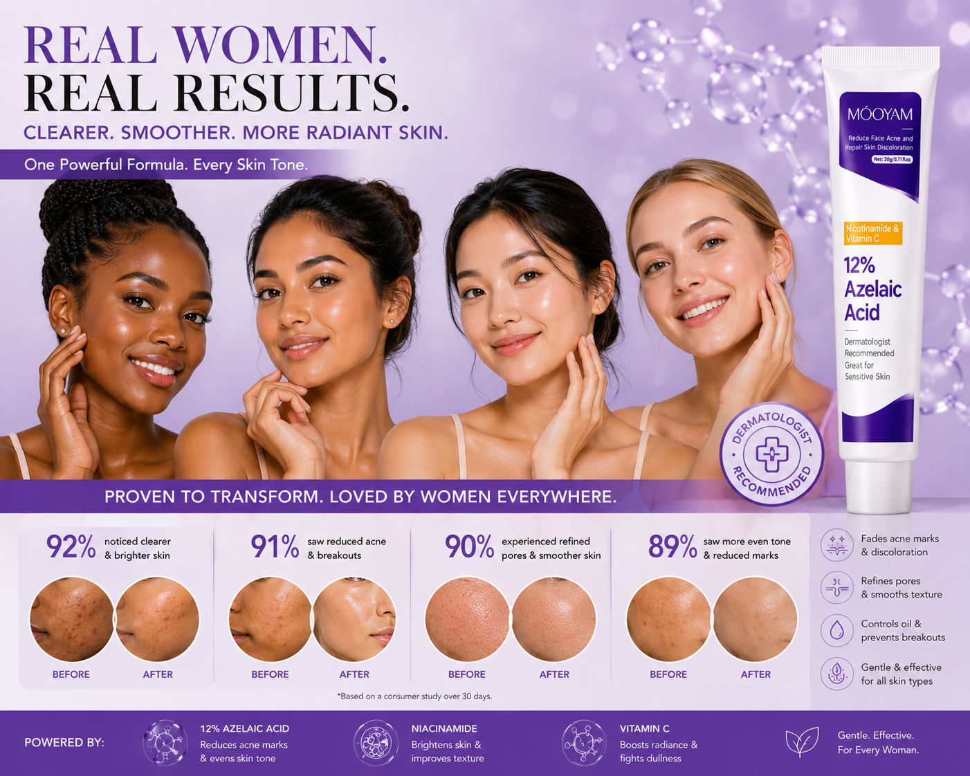 12%Azelaic Acid Cream with Niacinamide and Vitamin C for acne Prone Skin, Sensitive Skin, Large Pores and Pigmentation