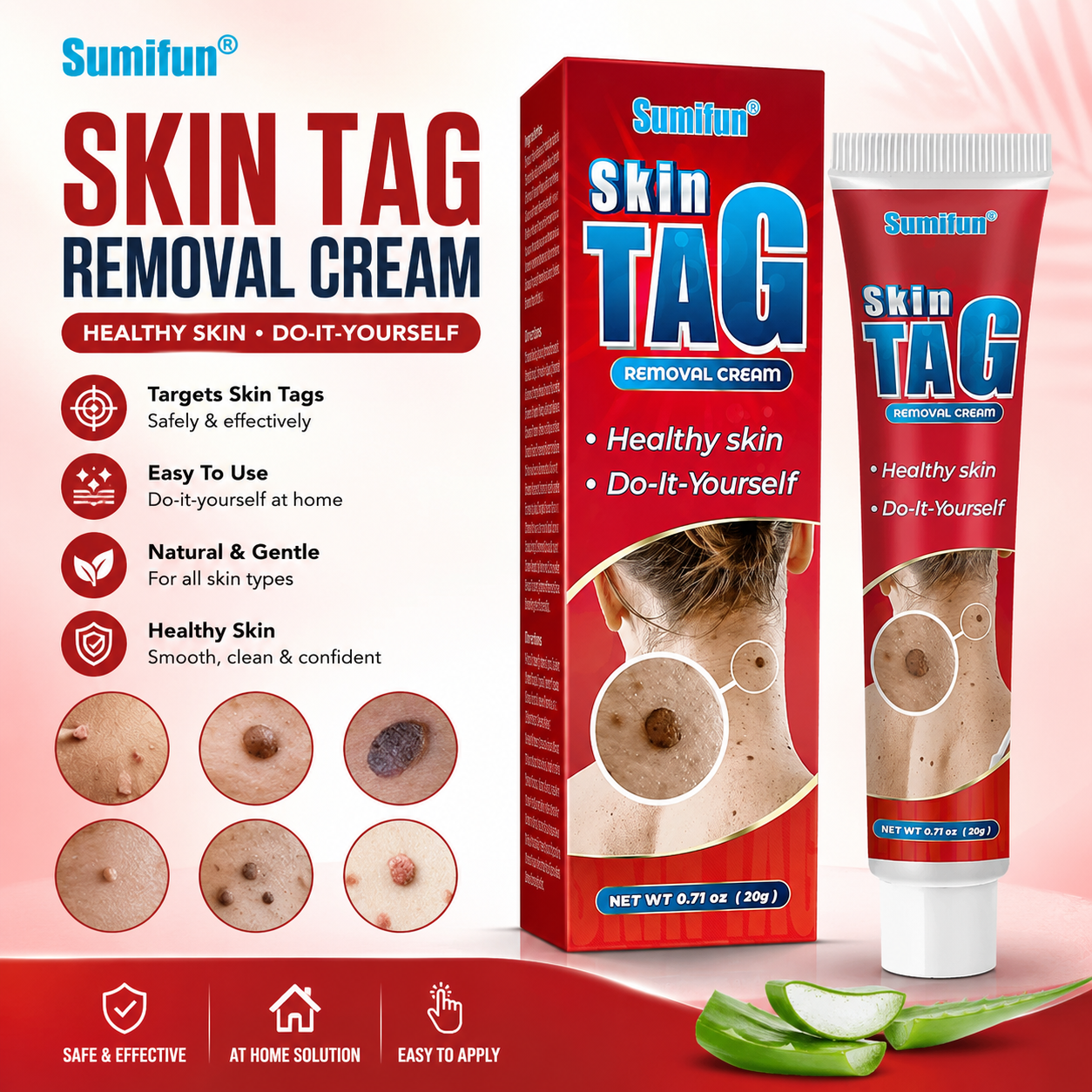 Skin Tag Removal Cream