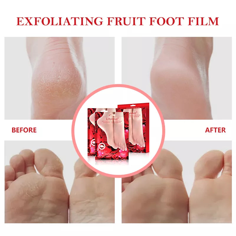 2 pairs Red Rose Exfoliating Foot Mask Effective for Dry and Cracked feet, Baby soft feet