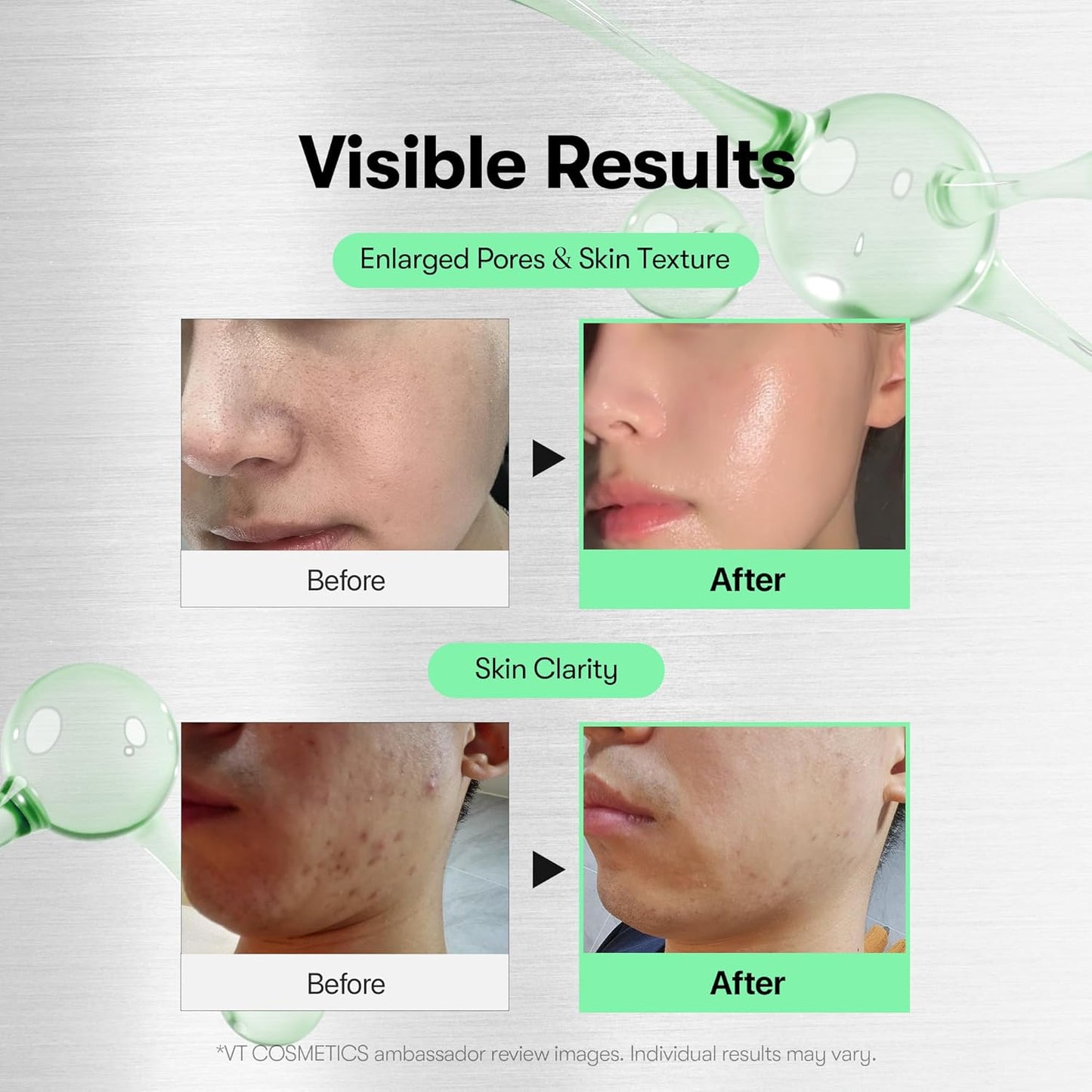 VT CICA Reedle Shot 100, Liquid Microneedling Spicule Serum for Pore Care, Exfoliation and Scarring