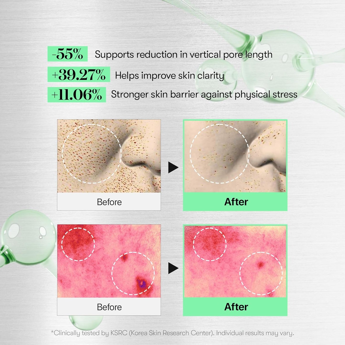 VT CICA Reedle Shot 100, Liquid Microneedling Spicule Serum for Pore Care, Exfoliation and Scarring