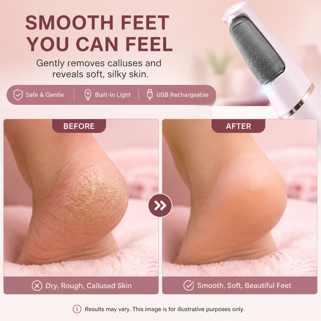 Rechargeable Electric Foot File Callus Remover for smooth soft feet
