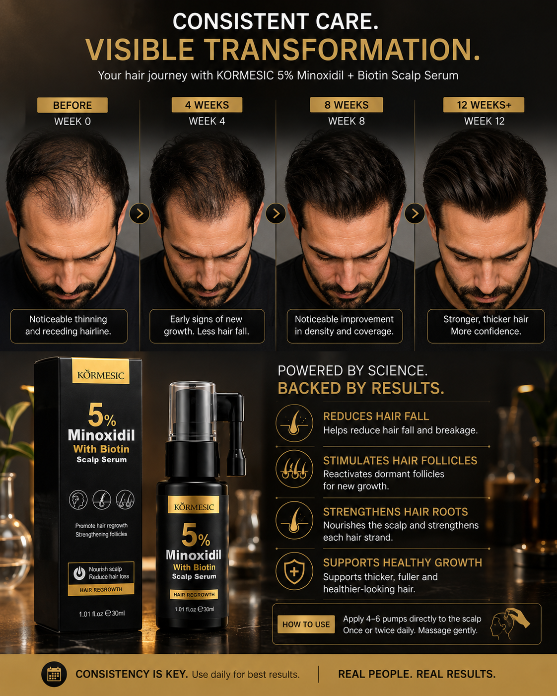 Kormesic 5% Minoxidil With Biotin – Advanced Hair Regrowth Scalp Serum